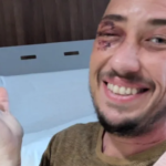 Chicago Trans Man Beaten in Possible Hate Crime